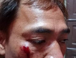 Wartawan di Pagar Alam Dianiaya Kontraktor, IWOI Sumsel Desak Polisi Usut Tuntas